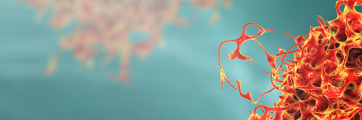 Pautas de actuación en Urología Oncológica. Volumen 2 Pautas de actuación en Urología Oncológica. Volumen 2